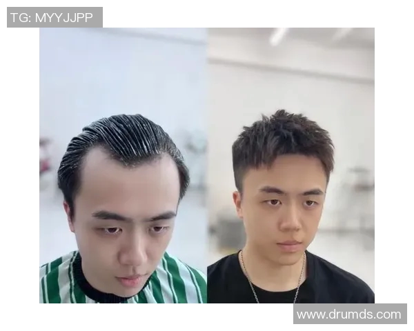 足球场上的M字发际线明星们如何逆袭成就辉煌人生